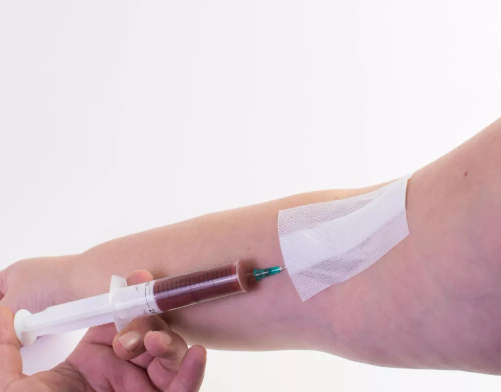 A small blood draw