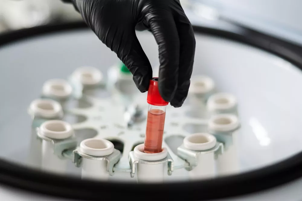 Centrifuge preparation