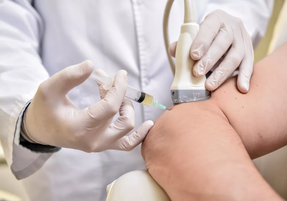 Targeted PRF injection