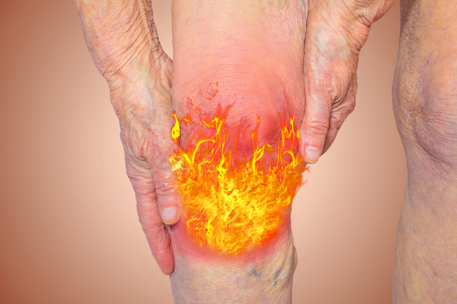 knee inflammation
